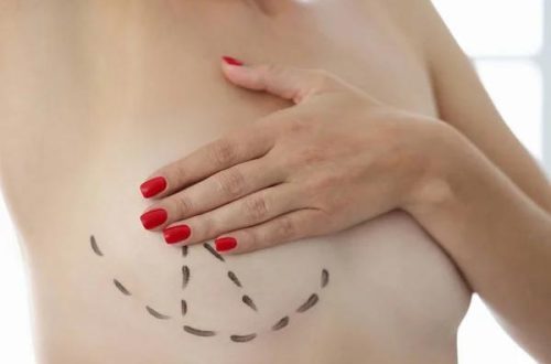 Why Choose Breast Reconstruction Specialists of NYC for Personalized Care